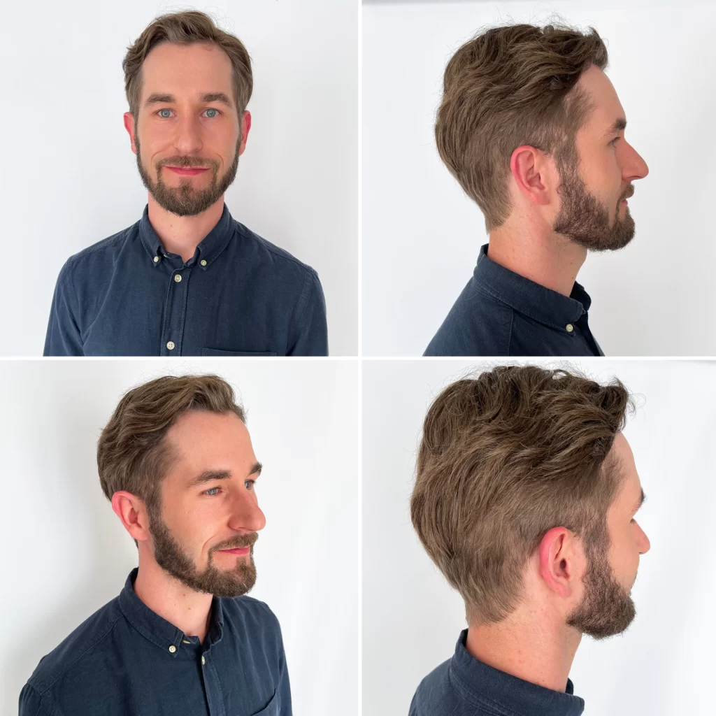 system-wlosow-dla-mezczyzn-efekty System włosów dla mężczyzn efekty