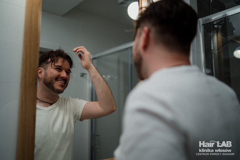 niechirurgiczny-system-uzupelniania-wlosow-dla-mezczyzn