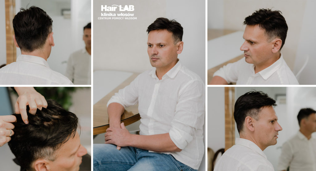 system-wlosow-dla-mezczyzn