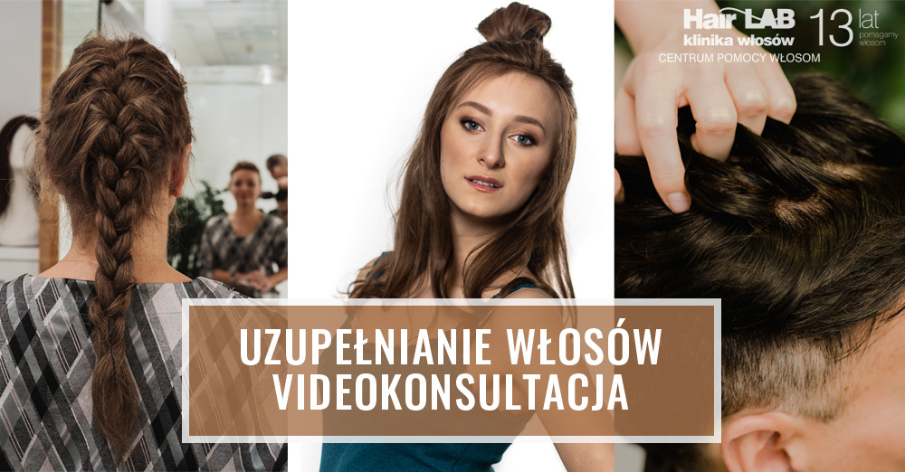 KONSULTACJA-NIECHIRURGICZNE-UZUPELNIANIE-WLOSOW
