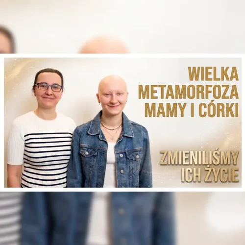 Metamorfoza łysienie plackowate miniaturka