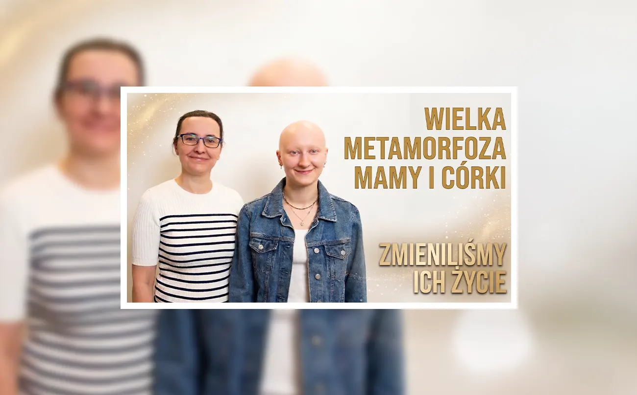 Metamorfoza łysienie plackowate miniaturka