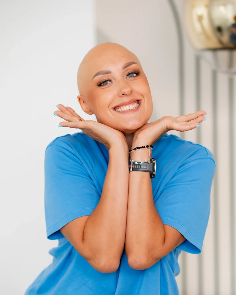 Alopecia kobieta łysienie placokwate